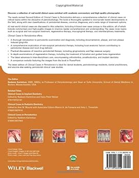 語学+参考書 Periodontics (2) (Dental clinical series basic) DENTAL CLINICAL SERIES BASIC Periodontics 2 重度歯周病罹患歯